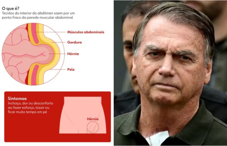 Bolsonaro já está no quarto e cirurgia não teve intercorrências, dizem médicos